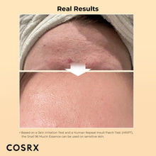 ギャラリービューアに画像を読み込み、COSRX Snail Mucin 96% Power Face Serum 3.38 fl oz 100ml, Hydrating Serum for Face, Self Care, Glow Skin under Makeup, Korean Skin Care, Korean Beauty